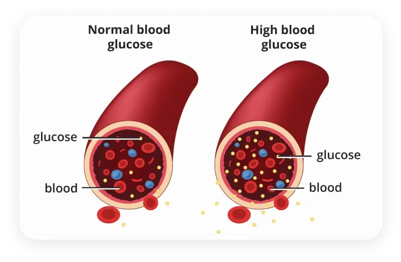 diabetes-treatment